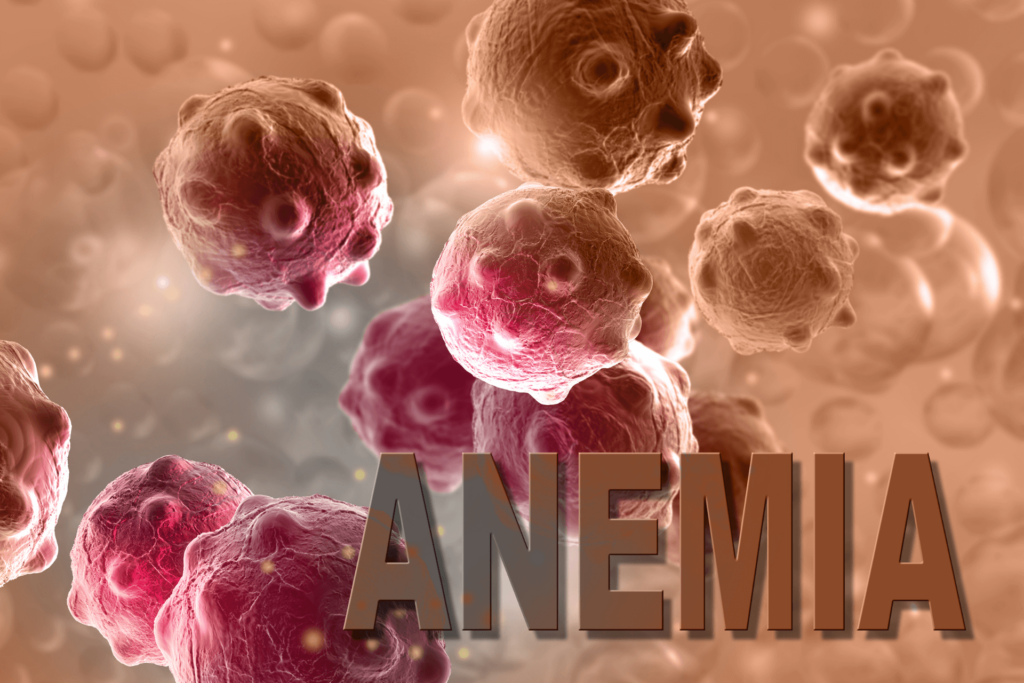 anemia 